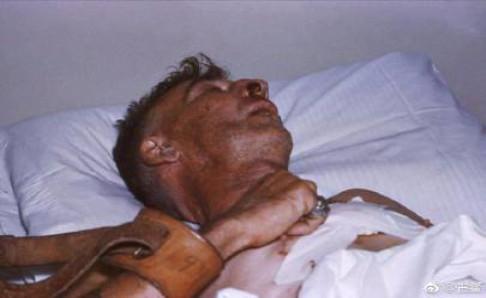 狂犬病为什么会学狗叫?可能是误解了