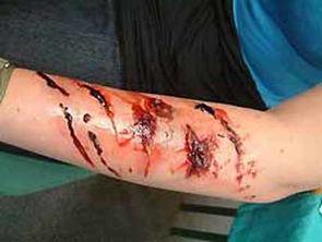 狂犬病传染吗？传染是有一定的条件的